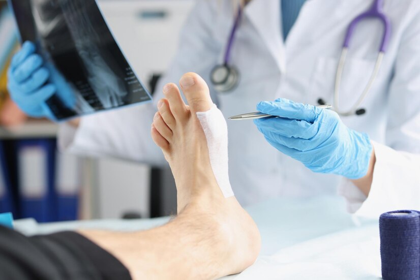 How Can I Identify And Diagnose Esfeet-Related Issues
